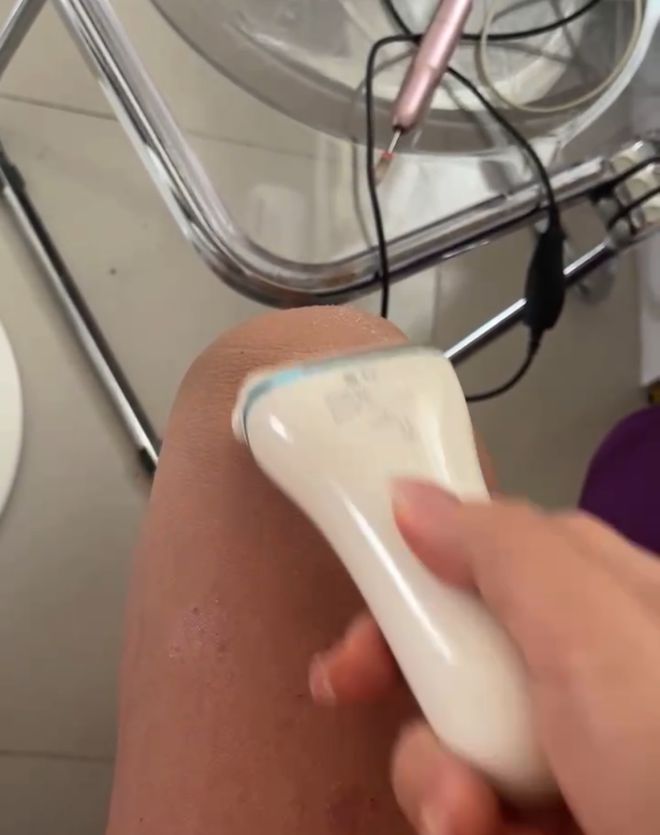 皮膚淀粉樣變最新治療進(jìn)展與策略綜述